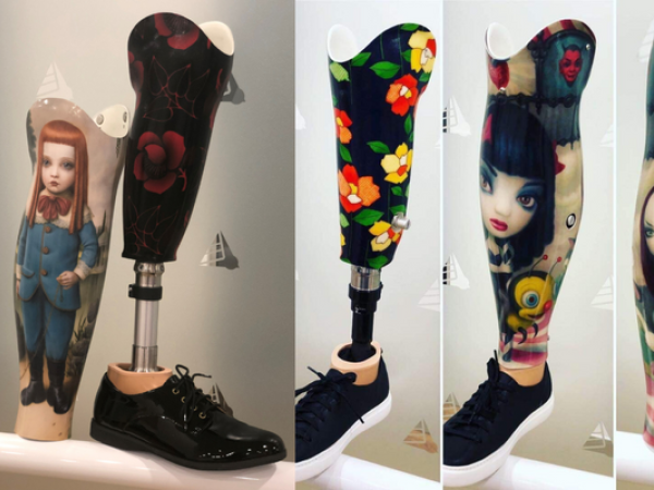 Prosthetic pride: finding your individual style
